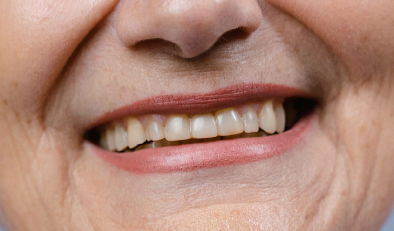 Why Are My Dentures Suddenly Loose?