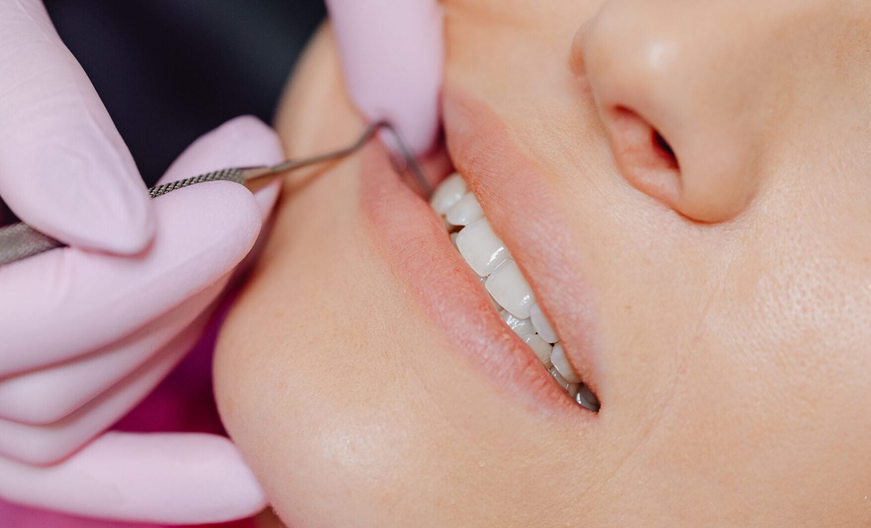 what to do if a filling falls out