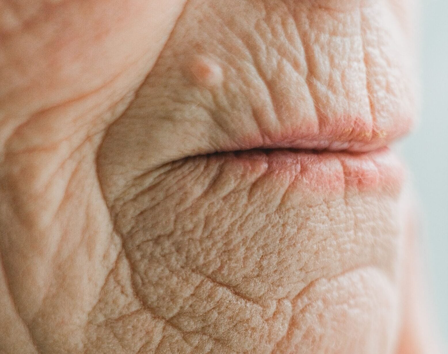 Can Missing Teeth Change Your Face?