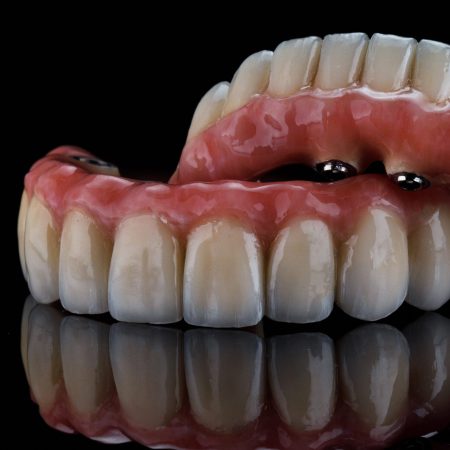 Beautiful Dental Ceramics and Titan Prostheses, Composition on Black Glass With Creative Reflection